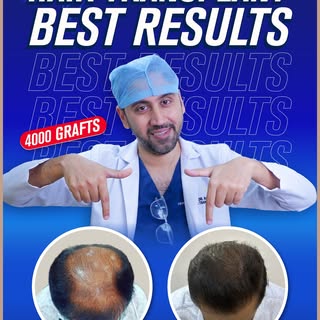 Male hair transplant | Best results | Before and after real transformation

Not every unsuccessful t