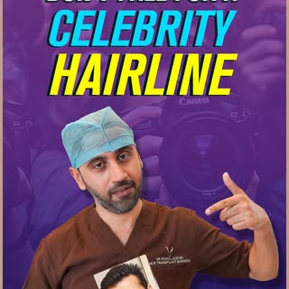 Get a Hairline that suits your age and shape of the face, not of any celebrity

A hairline is not ju
