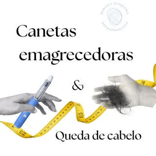 Se você está em uso dos análogos de GLP-1, as famosas “canetas emagrecedoras” e notou um aumento da 