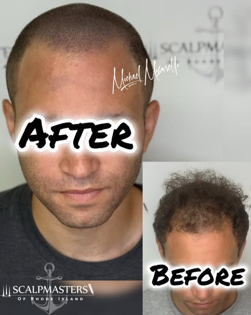 🔥 THE BEST OF BOTH WORLDS. 🔥

This client already had existing hair — he didn’t need to completely