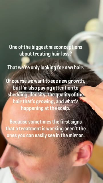 This is why I love being able to actually track what’s happening throughout a client’s hair growth j