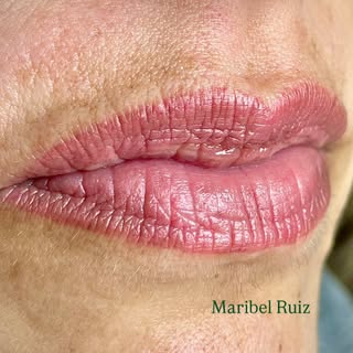 Así de lindos llegaron estos labios a su repaso a los 2 meses, casi perfectos❤️
. 
Citas 692 792 250