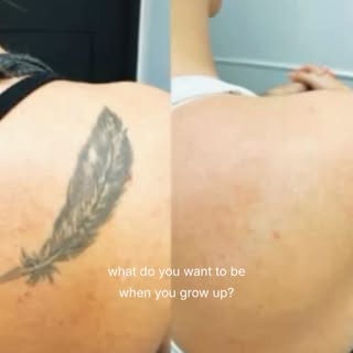 Bana en çok bu soruyu soruyorsunuz. Daha önce de defalarca anlattım. Bazen bana gelen hastalarımdan 