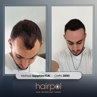 And one more is done. ✅
For a more confident look, your hair matters! 😎
Now it’s your turn. 
We’re 