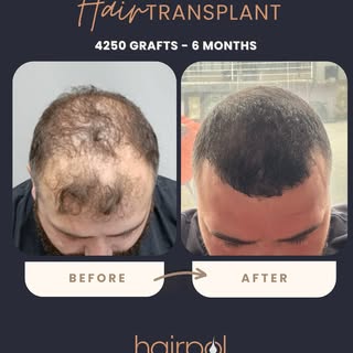 Our patient only at month 6 🤩 
Excited to see what’s coming next!

Ready to start your own transfor