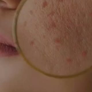 Glow goals, unlocked ✨
Experience the magic of a HydraFacial at Tricovia—where science meets self-ca