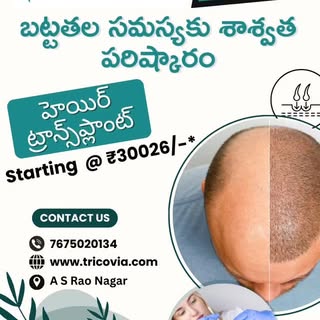 ఇక బట్టతలకి గుడ్‌బై చెప్పే టైమ్ వచ్చేసింది! 💫
TRICOVIA Hair • Skin • Laser లో Advanced Hair Transpl
