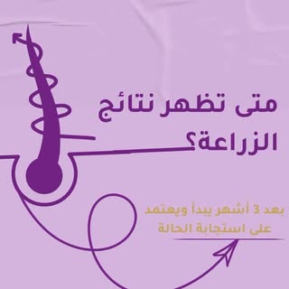 حلة الزراعة تبدأ اليوم… والنتيجة تبدأ تظهر قريب وش تنتظر احجز موعدك الان #مركز_أدمة #الرياض #زراعة_ا