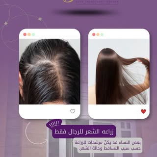 زراعة الشعر ليست حكرًا على الرجال 👩🏻‍🦱

قد تكون زراعة الشعر خيارًا مناسبًا للنساء أيضًا، في بعض ح