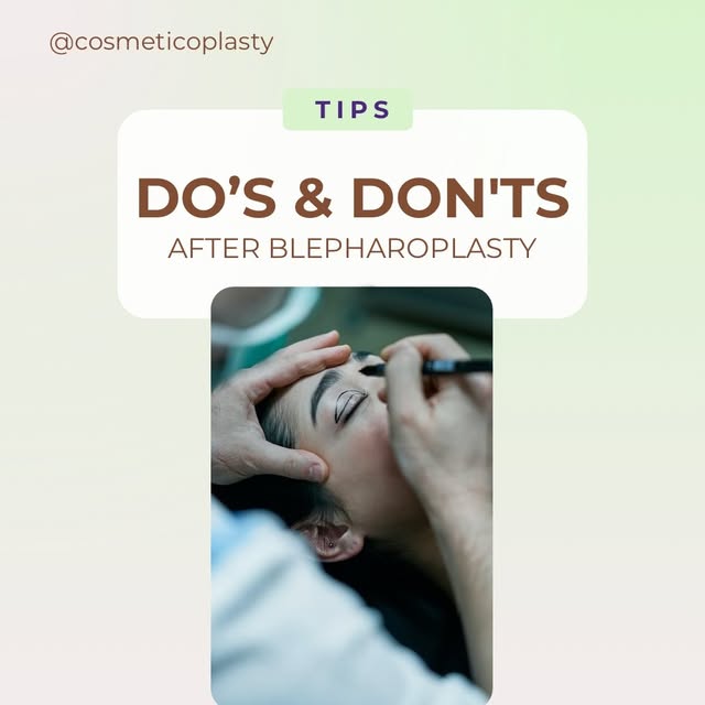 Blepharoplasty recovery: the small things you do after eyelid surgery can make a significant differe