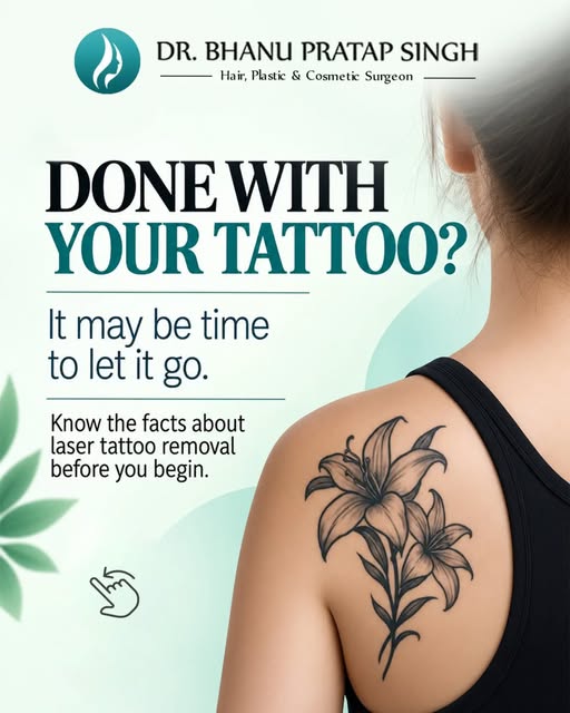 Thinking about tattoo removal? Laser tattoo removal can help break down tattoo ink gradually for a c