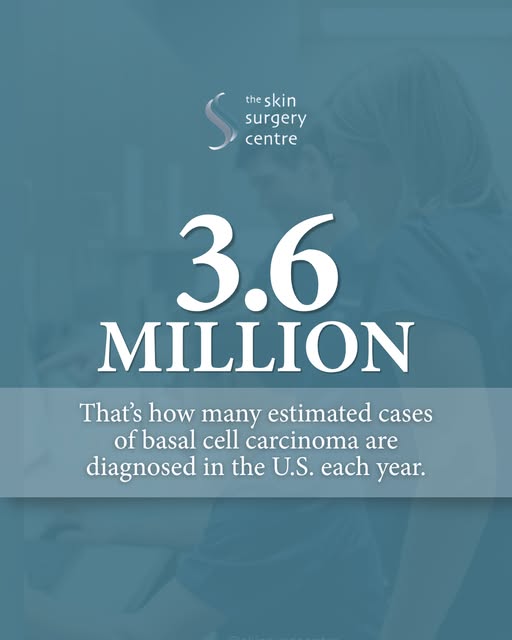 Basal cell carcinoma is common, but that doesn’t mean it should be ignored.

An estimated 3.6 millio