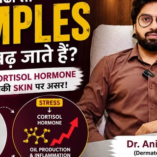 Stress बढ़ा तो Pimples क्यों बढ़ जाते हैं?
जब हम stress में होते हैं, शरीर में Cortisol hormone का l