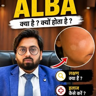 Pityriasis Alba – चेहरे पर दिखने वाले सफेद दाग आखिर क्यों होते हैं? 🤔

क्या आपके चेहरे पर भी हल्के 
