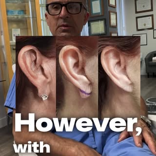It’s a myth that torn or stretched earlobes can’t be fixed.

With the right surgical technique, earl