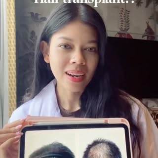 Kalau nggak dikasih tahu, kamu sadar nggak kalau ini hasil hair transplant? 👀

Banyak orang mengira