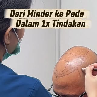 Minder karena rambut menipis? Tidak harus selamanya.

Satu tindakan bisa menjadi awal perubahan menu