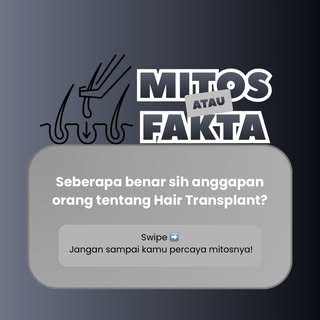 Masih percaya kalau hair transplant itu rambut palsu? 👀
Atau setelah transplant rambut langsung tum