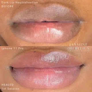 🔥 Dark Lip Neautralization 🔥 For those that wish to lighten their lips and give a neautral or pink