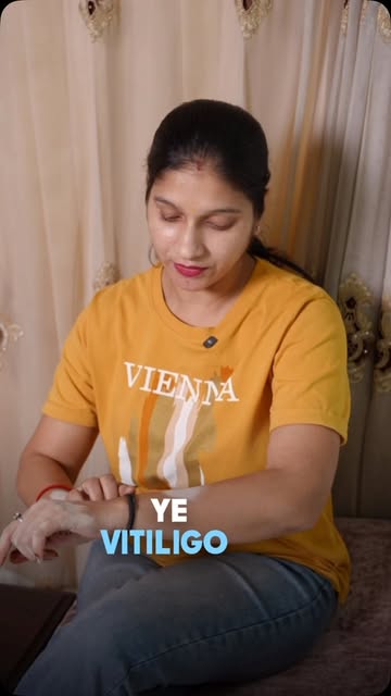 Vitiligo is treatable!!

Dm to explore treatment options 

Contact Number-94651 21492

#skinclinic #