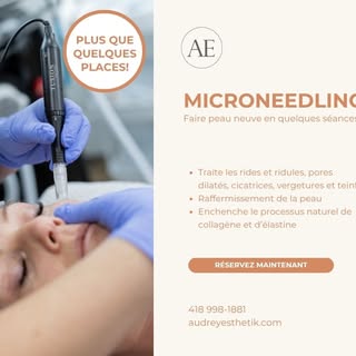 Réservez dès maintenant votre microneedling pour cet automne ✨

Le microneedling stimule naturelleme