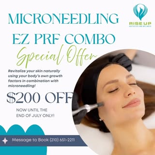 ✨ **LIMITED-TIME SPECIAL!** ✨

💉✨ Rejuvenate your skin with our **Microneedling + EZ PRF Combo** an