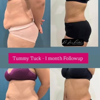 She didn’t just lose inches…
She found herself again. ❤️

Post-pregnancy / weight loss bodies deserv