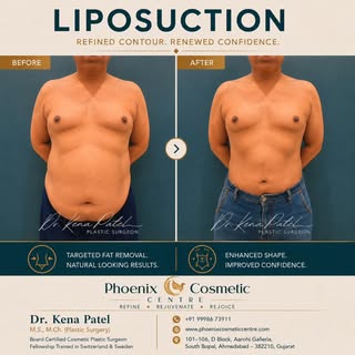 A refined contour. A renewed confidence.

Every body tells a different story, and every transformati