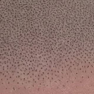 Close-up of a Scalp Micropigmentation treatment just done 
——
ink @pygmenta_ink 
needles @black_rain
