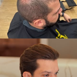 “Eu já tinha desistido do meu cabelo.”

Essa foi uma das frases que mais marcou esse depoimento.

Du