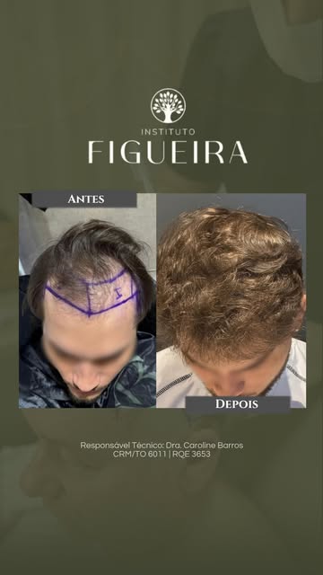 Transformar a autoestima e devolver a liberdade de viver sem preocupações é o nosso principal objeti