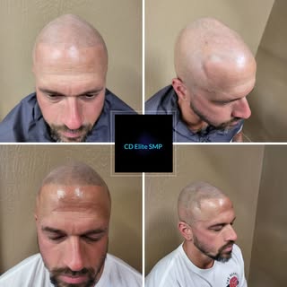 #cdelitesmp #scalpmicropigmentation #hairtatoo #permanentlining #confidence
