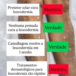 Camuflagem estética é a melhor e mais rápida opção para quem se incomoda com as manchas brancas da l