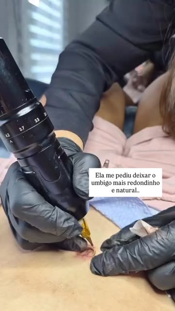 Reconstrução de umbigo! técnica da micropigmentação paramédica para devolver profundidade, contorno 