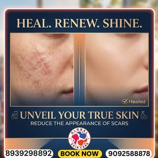Restore Your Confidence with Advanced Scar Treatment
Scars may tell a story—but they don't have to d