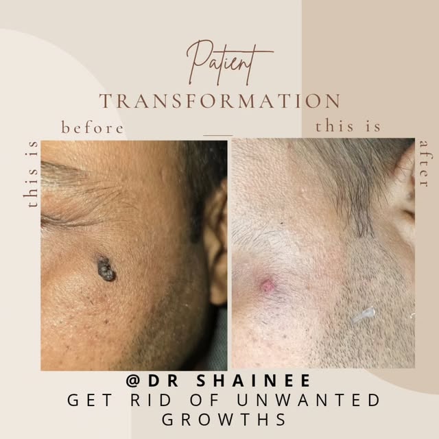 Transformations that matters.....☺️