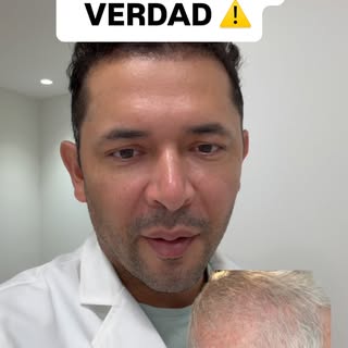 ¿Miedo a perder el pelo tras el injerto capilar? No entres en pánico 🚫💇‍♂️
El famoso “Shock Loss” 