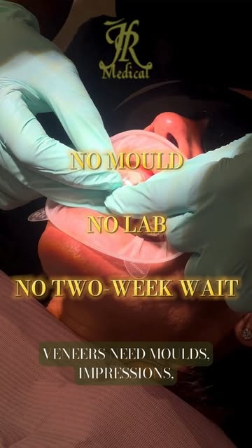 Composite bonding isn't a one-size-fits-all fix. It's built for your teeth, in your mouth, during th