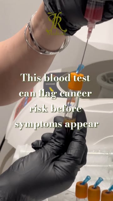 Most cancer screening happens after something's already wrong. TruCheck™ Intelli is designed to flag