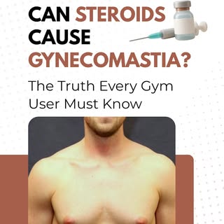 Can Steroids Cause Gynecomastia? Expert Advice by Dr. Rushin Thakor | Best Gynecomastia Treatment in