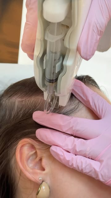 Cuidar da queda de cabelo também é cuidar da saúde do couro cabeludo.

A MesojectGun é uma tecnologi