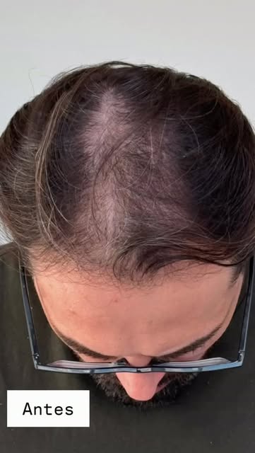 PARECE OUTRA PESSOA. MAS É O MESMO HOMEM. 👀

O que mudou?

O cabelo.
A moldura do rosto.
E, princip