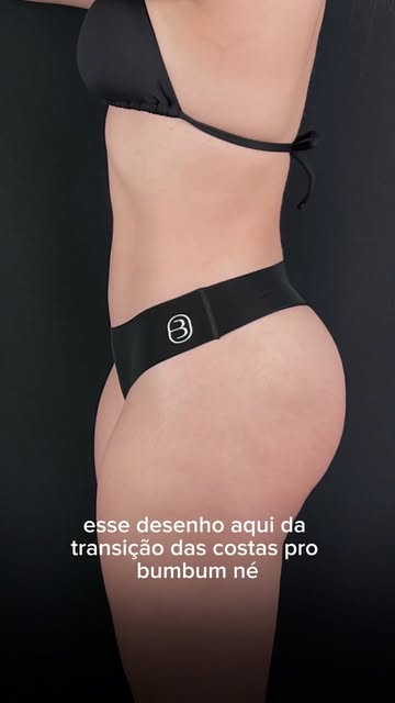 Três meses de lipoescultura e um resultado que já traduz exatamente o que planejamos: contornos mais