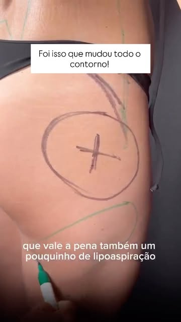 O que realmente mudou todo esse contorno?

Ela já tinha um bumbum bonito. Por isso, o objetivo não e