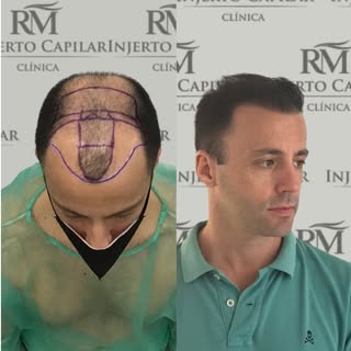 Increíbles resultados, en tan solo 10 meses gracias por confiar en nosotros! 

Nuestros pacientes si