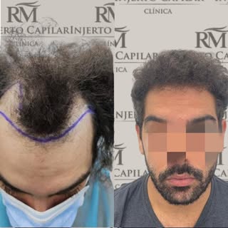 No lo dudes más…… y llámenos al +34 624 040 364 y di adiós a sus entradas! 

¿Porque no lo hice ante