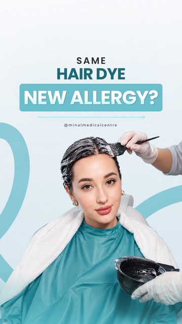 Using the same hair dye for years doesn’t mean you can’t suddenly develop an allergy.

Itching, burn
