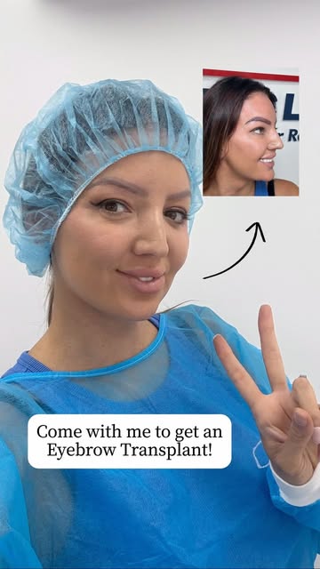 ‘Come with me to get an eyebrow transplant at The British Hair Clinic ✨’ -  @laylachapman_ 

Layla c
