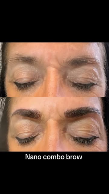 #NanoBrows #BrowTransformation #PermanentMakeup #CosmeticTattoo #PowderBrows

Nano Combo Brows are o