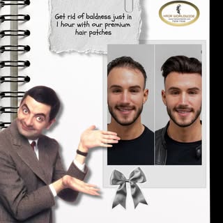 Why wait months when confidence takes just 1 hour? 😉
Say goodbye to baldness and hello to a natural